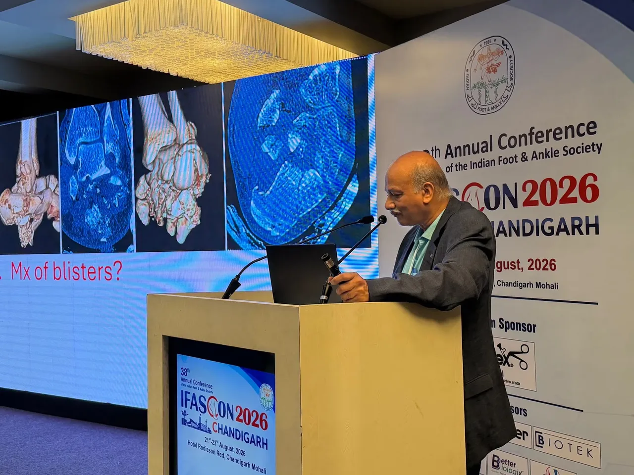 Indian Foot and Ankle Society - IFASCON 2026 - Chandigarh 38th Annual National Conference of Indian Foot and Ankle Society