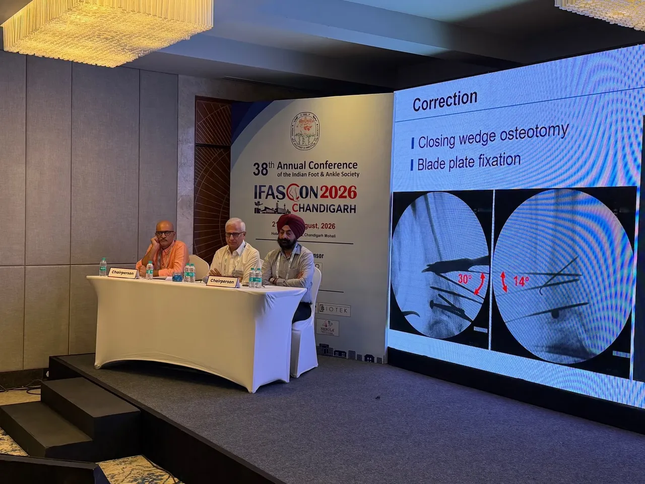 Indian Foot and Ankle Society - IFASCON 2026 - Chandigarh 38th Annual National Conference of Indian Foot and Ankle Society